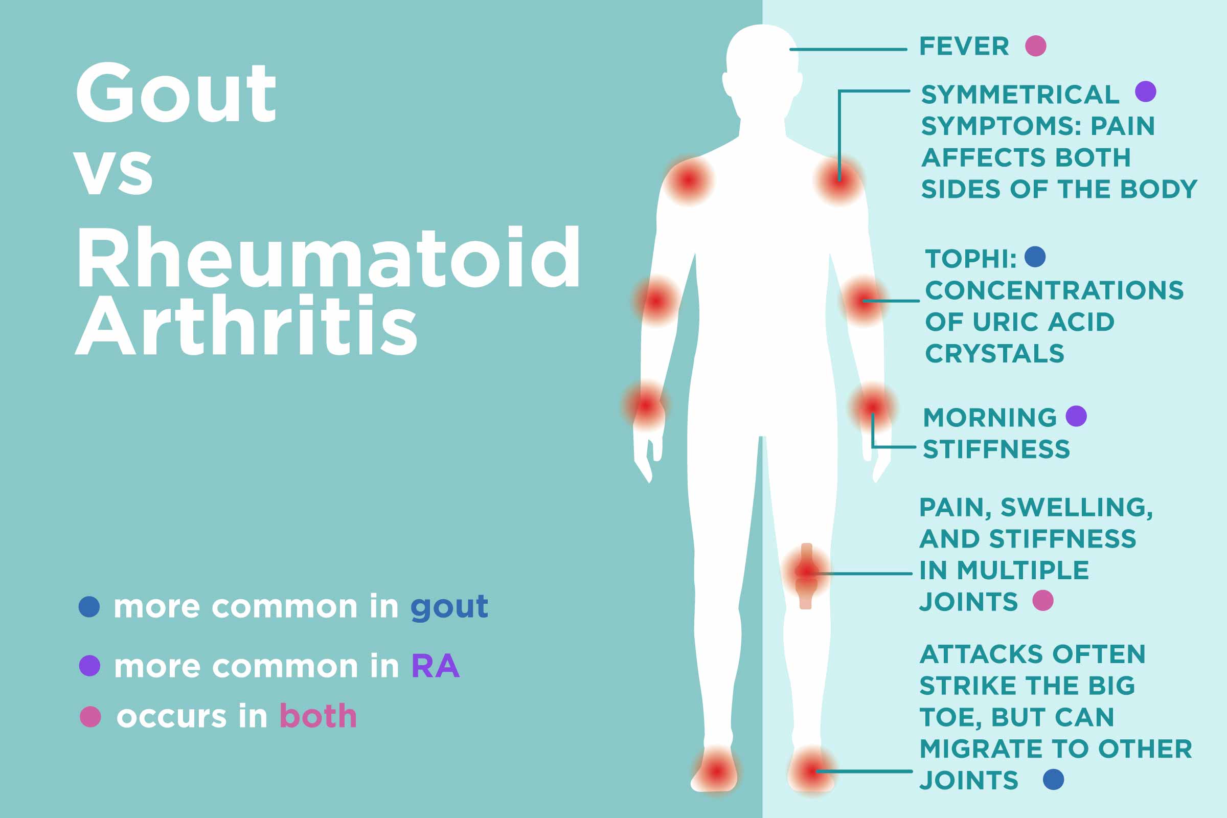 Gout vs. Rheumatoid Arthritis: Whats the Difference?