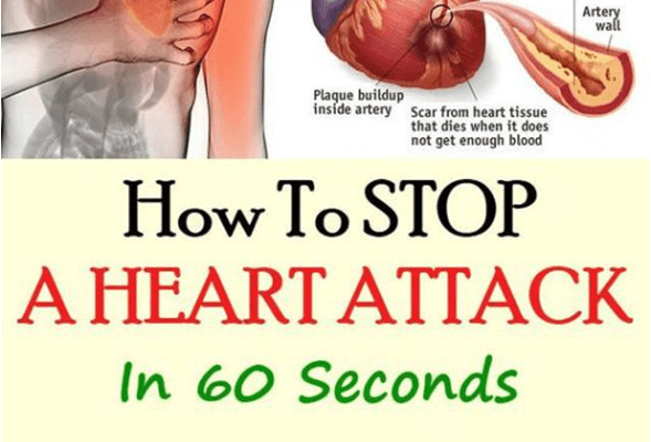 Heres How To Stop A Heart Attack In 60 Seconds, You Must ...
