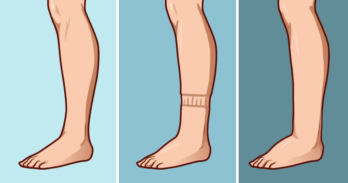 Home remedies for swollen calves and water retention  1K ...