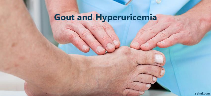 How Hyperuricemia (High Uric Acid Levels) Affect Gout?