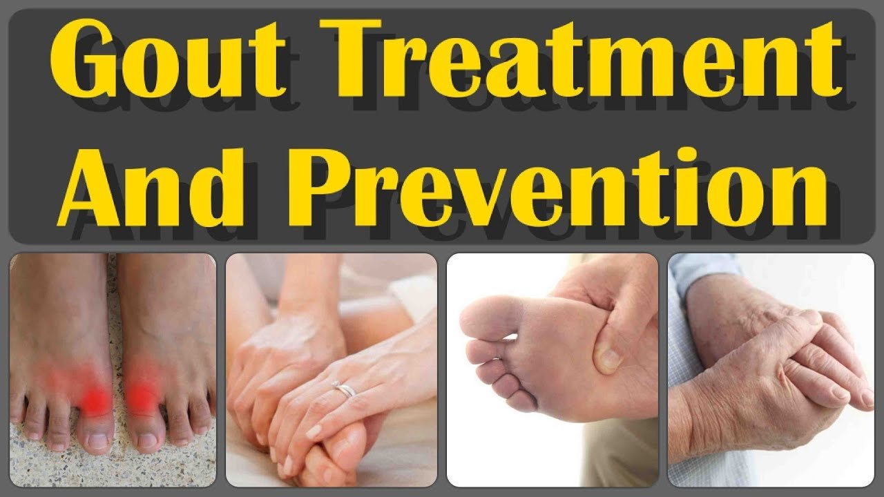 How To Decrease Gout and Gout Treatment &  Prevention For ...