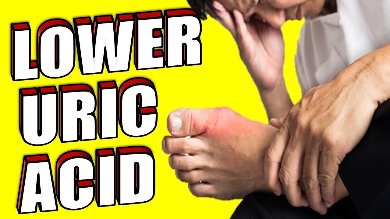 How To Decrease Your Uric Acid Levels Naturally &  Get Rid of Gout For ...