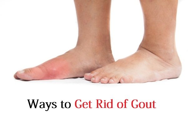 How to Get Rid of Gout?