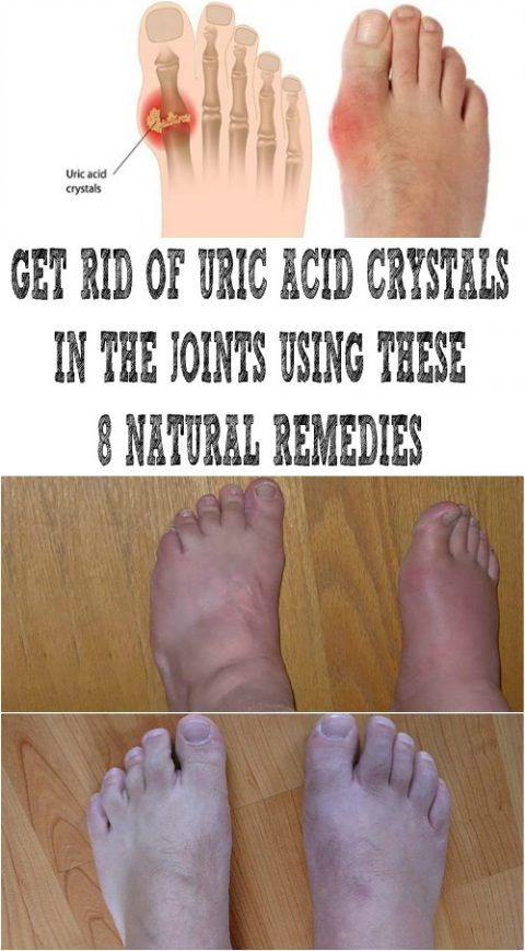 How to get rid of uric acid in foot, ALQURUMRESORT.COM