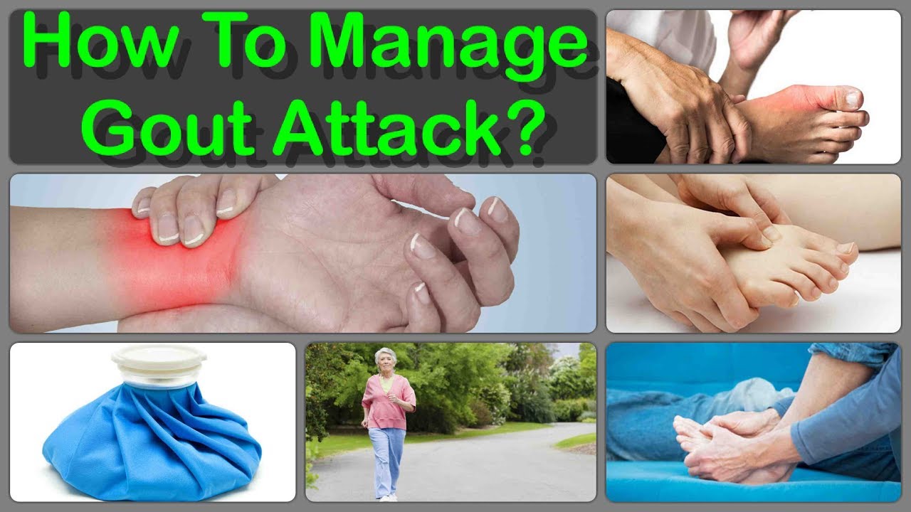 How To Manage a Gout Attack And How I Stop My Gout Attack ...
