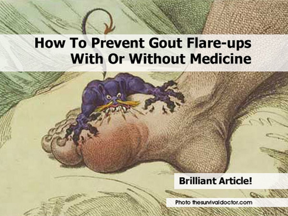 How To Prevent Gout Flare