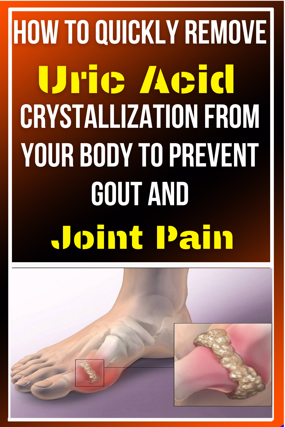 How To Quickly Remove Uric Acid Crystallization From Your ...