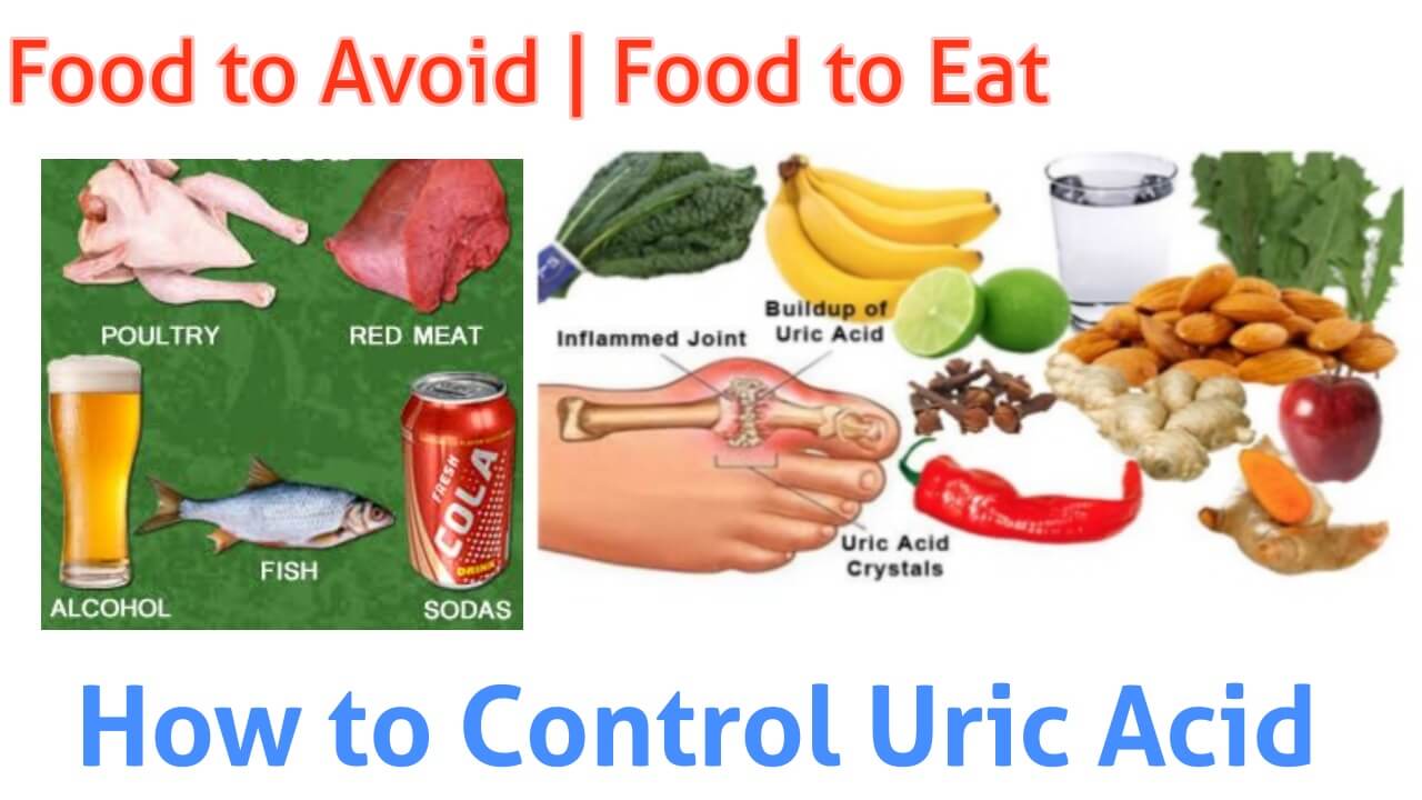 How to Reduce Uric Acid Naturally