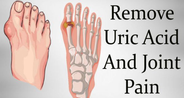 How To Remove Gout and Joint Pain (Uric Acid and Crystals ...
