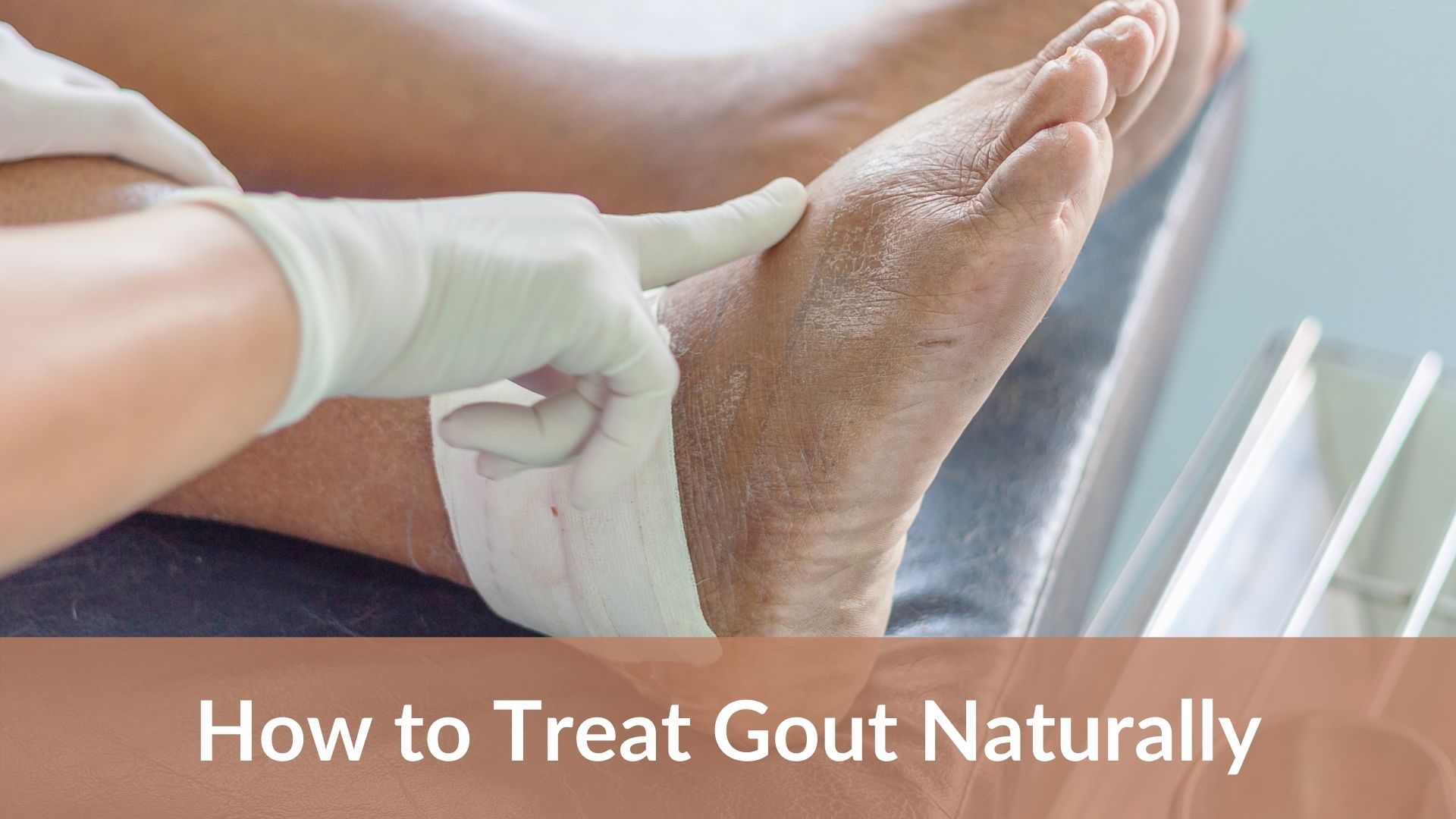 How to Treat Gout at Home