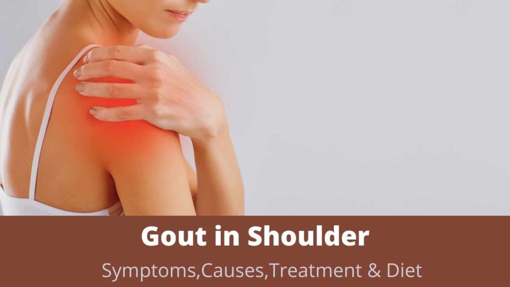 How to Treat Gout In Shoulder
