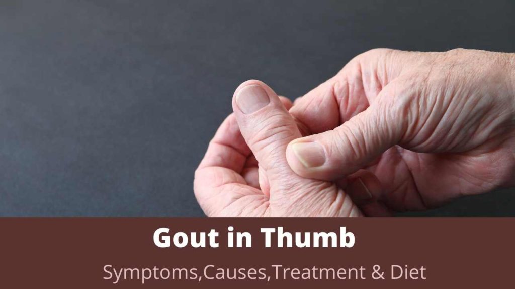 How to Treat Gout in Thumb with Home Remedies