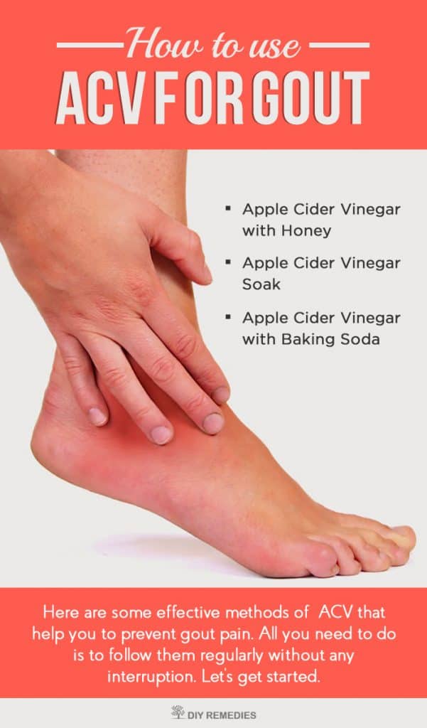 How to use Apple Cider Vinegar for Gout