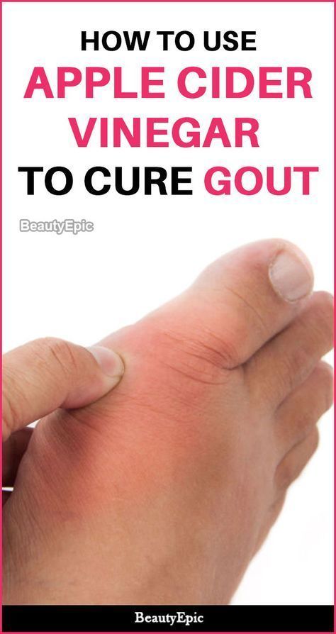 How to use Apple Cider Vinegar To Cure Gout
