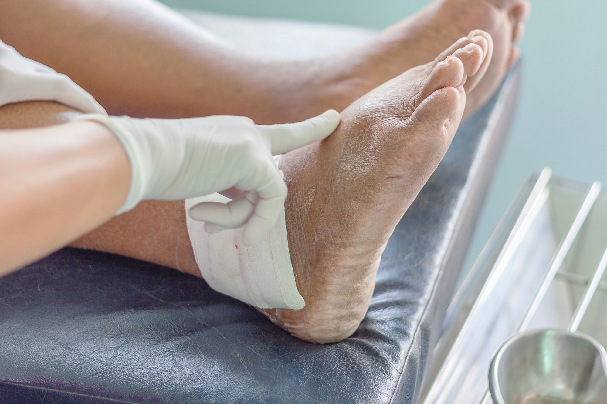 How Top Experts Are Advancing Gout Care in the United States