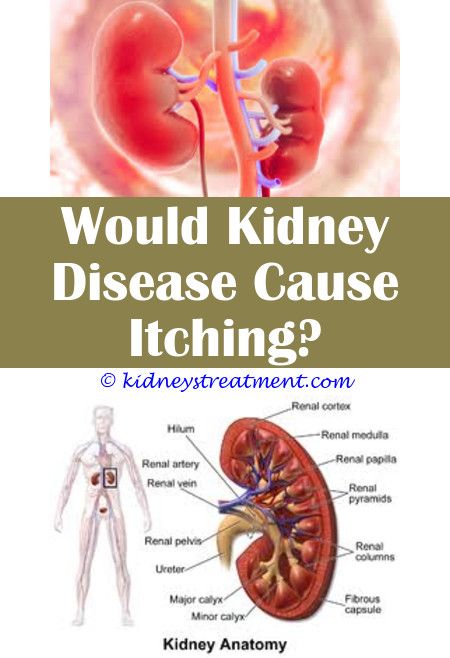Kidney Disease And Gout