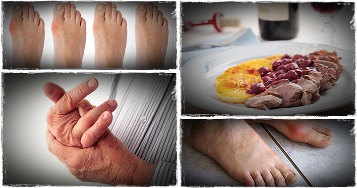 List of bad foods for gout for people to avoid, and get ...