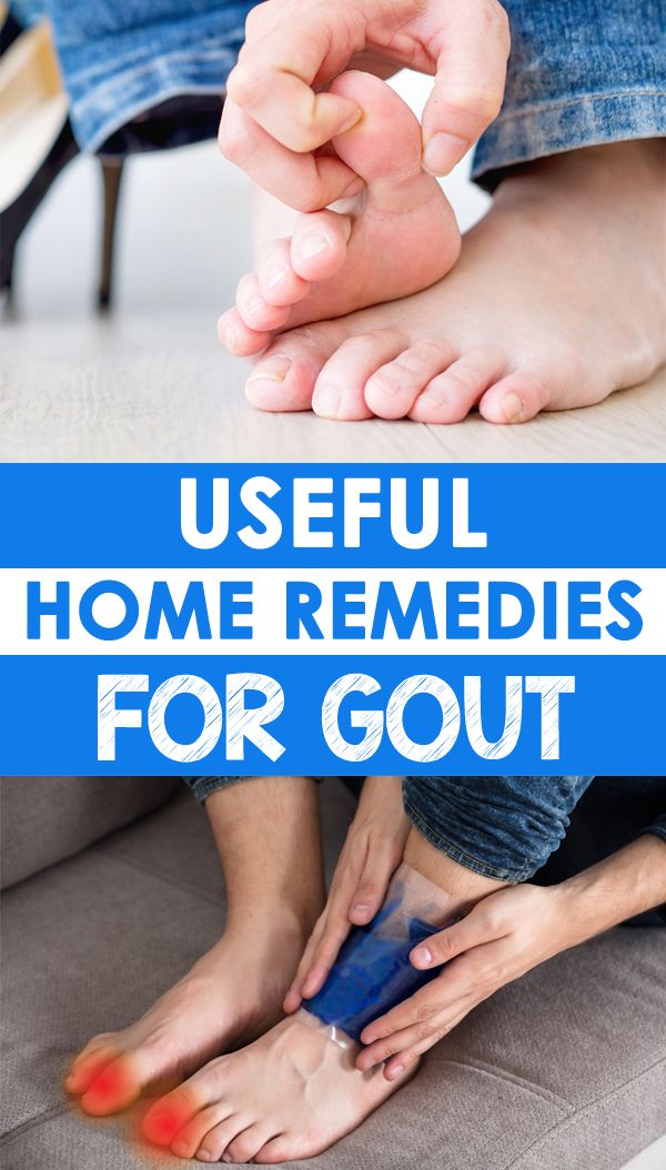 List of Useful Home Remedies for Gout