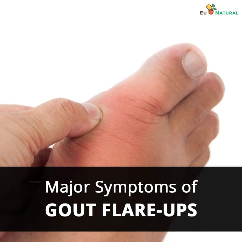 Major Symptoms of Gout Flare