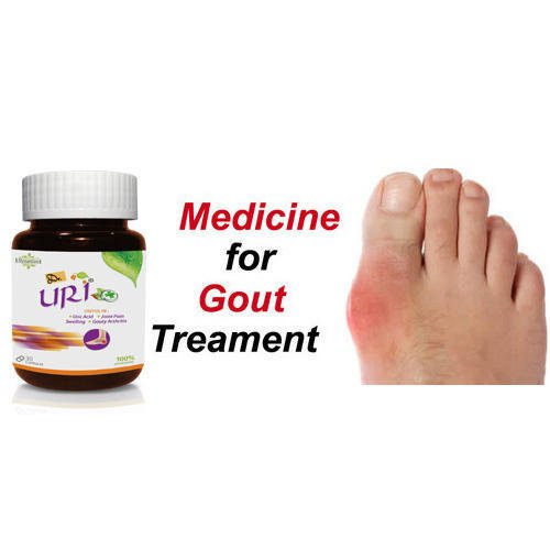 Medicine for Gout Treament, Gout Treatment