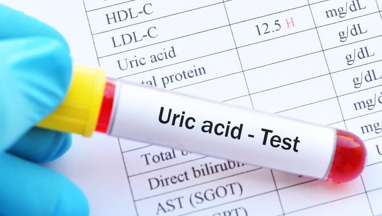 My mom got diagnosed with high uric acid. Heres ...