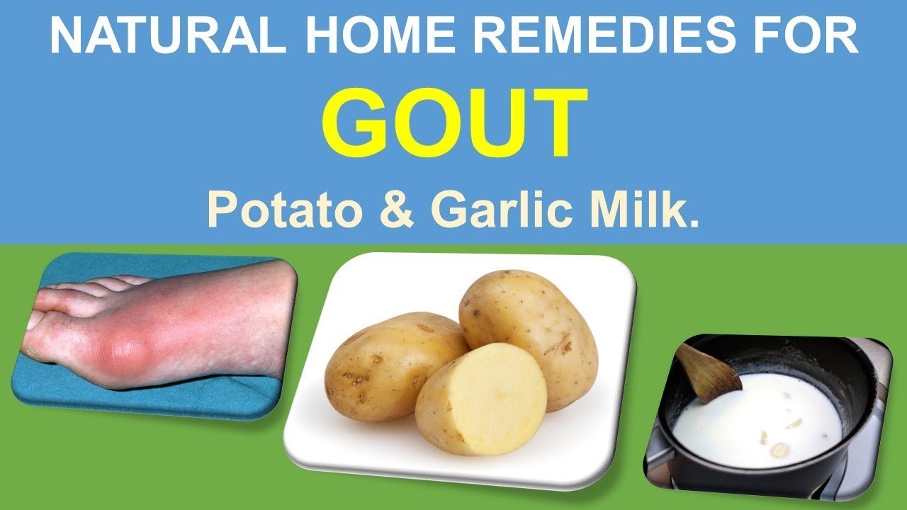 NATURAL HOME REMEDIES FOR GOUT