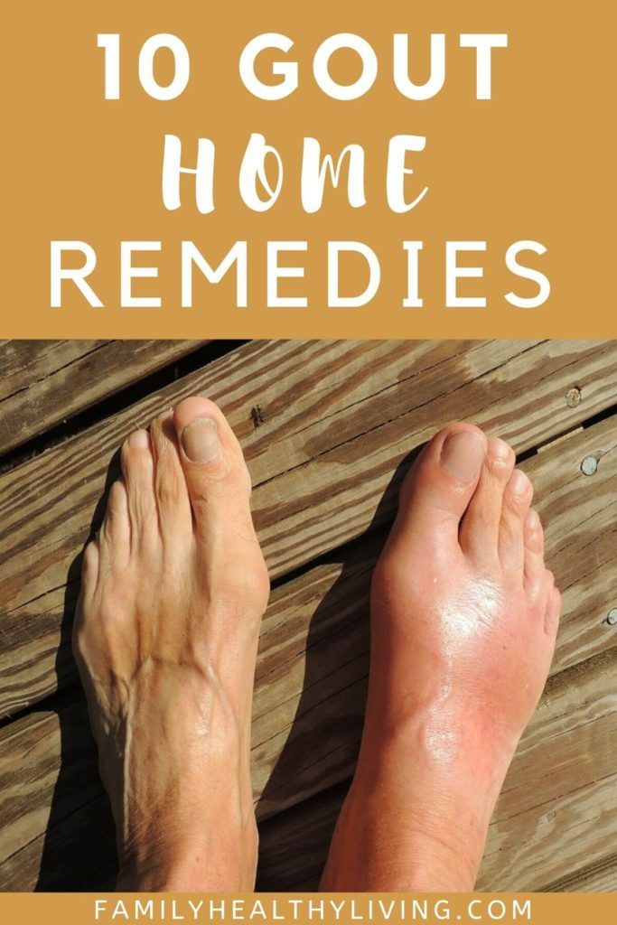 #natural home remedies in 2020