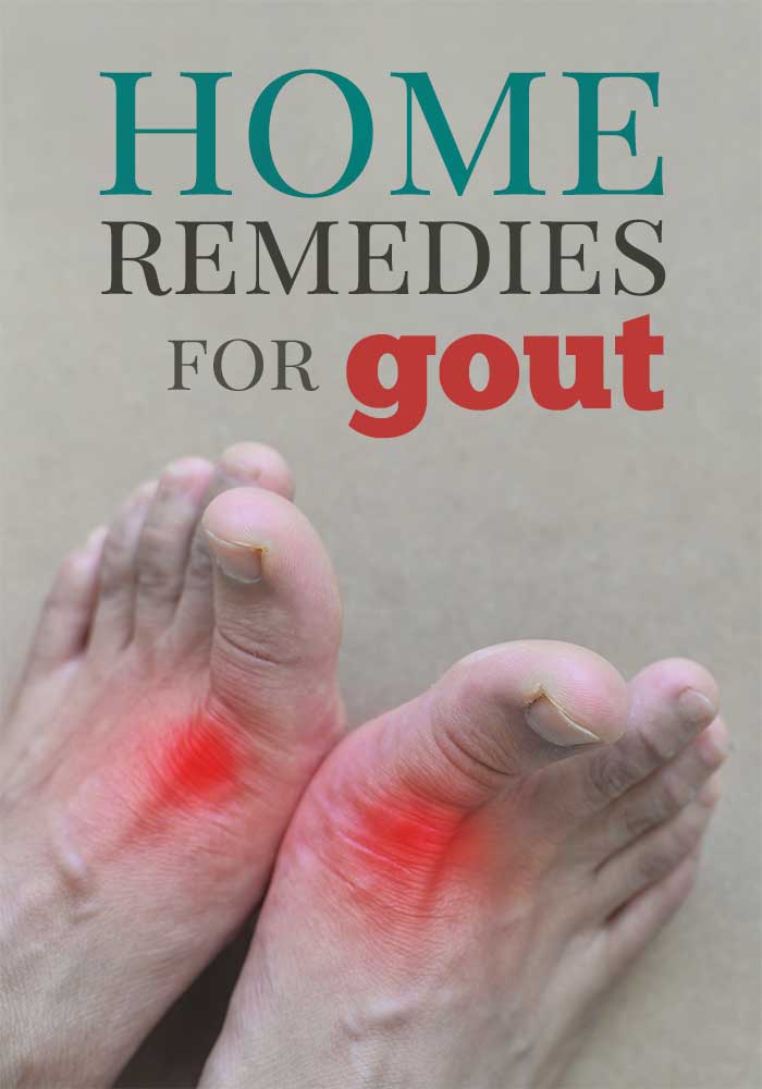 Natural Home Remedies to Treat Gout