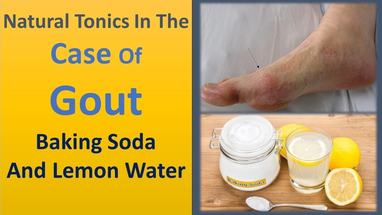 Natural tonics in the case of gout