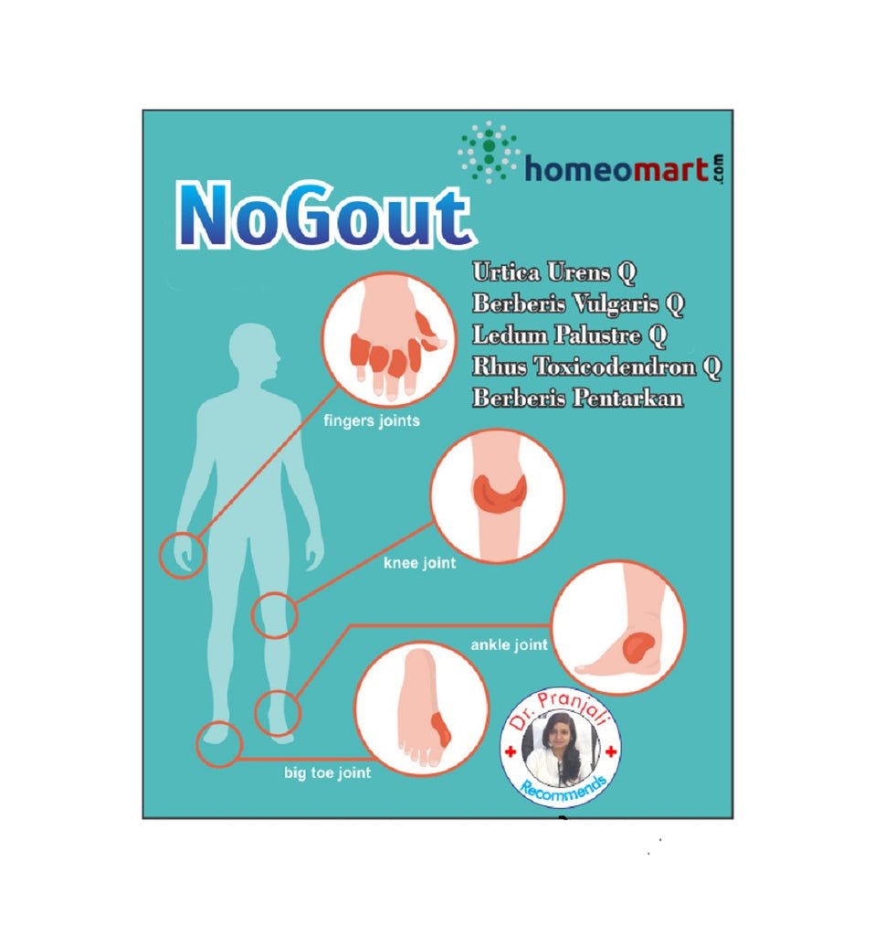 NoGout Homeopathy Medicine Kit for Gout treatment, High Uric Acid