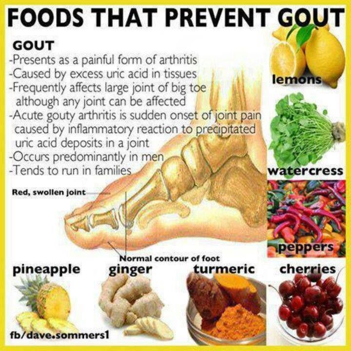 Occurence and prevention of gout: what foods to avoid and ...