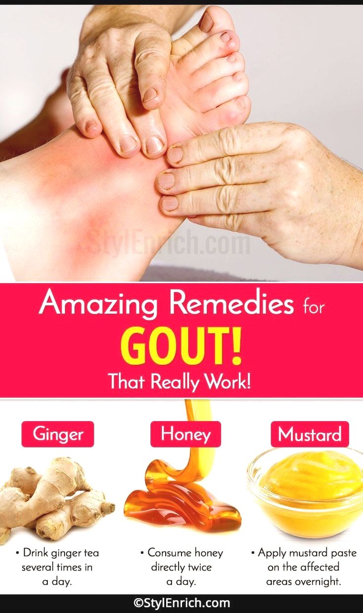 Pin on Health / Home Remedies