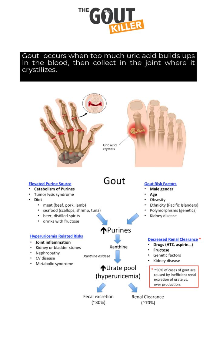 Pin on How To Prevent Gout Attacks
