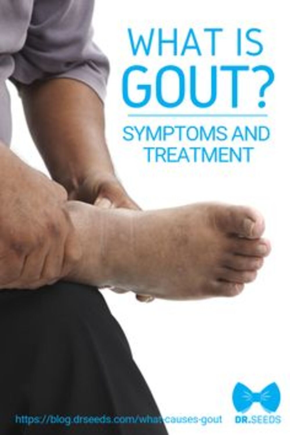 Pin on Treatment for Gout