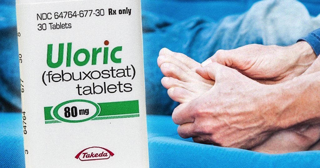 Popular Gout Medication Uloric Linked To Increase Risk Of ...