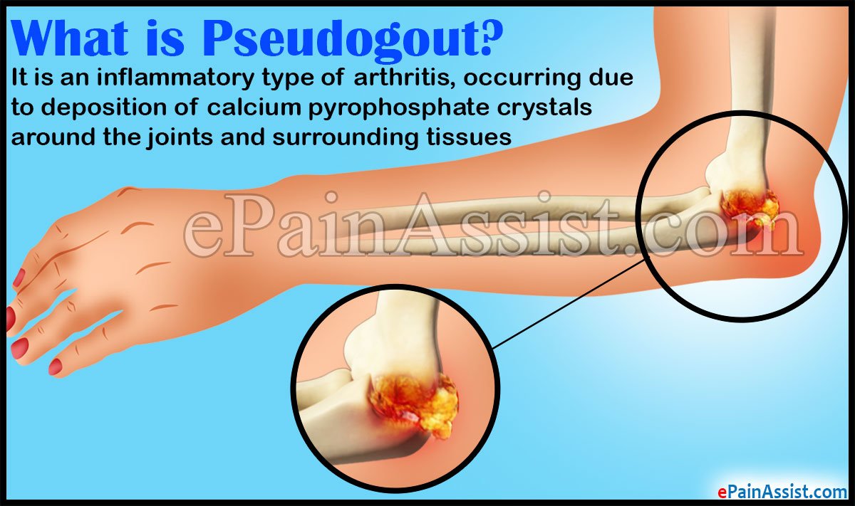 Pseudogout in Elbow