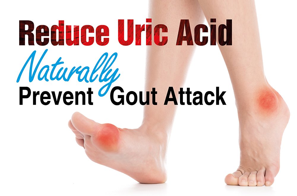 Reduce Uric Acid Naturally, Prevent Gout Attack