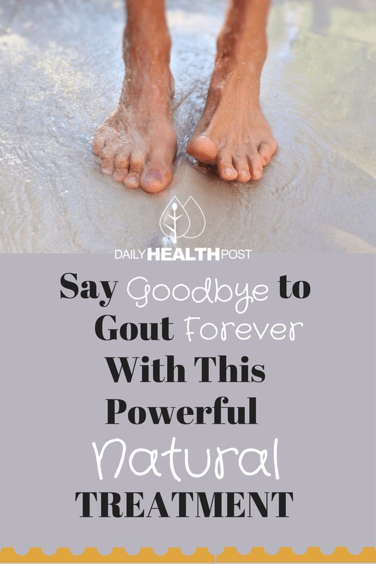 Say Goodbye To Gout Forever With This Powerful Natural ...