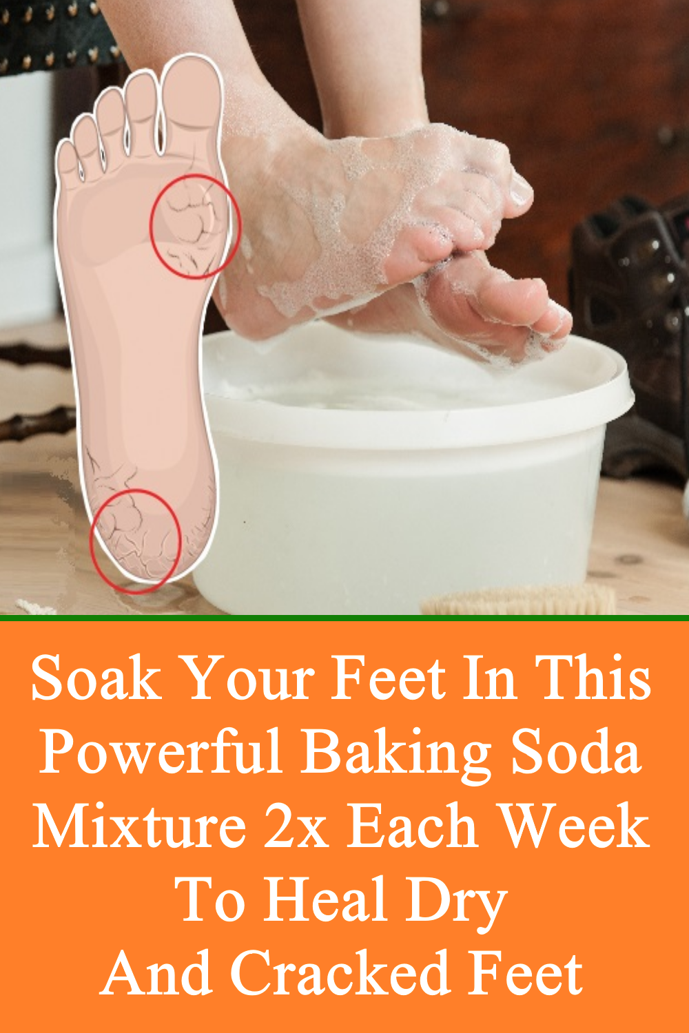 Soak Your Feet in This Powerful Baking Soda Mixture 2x ...