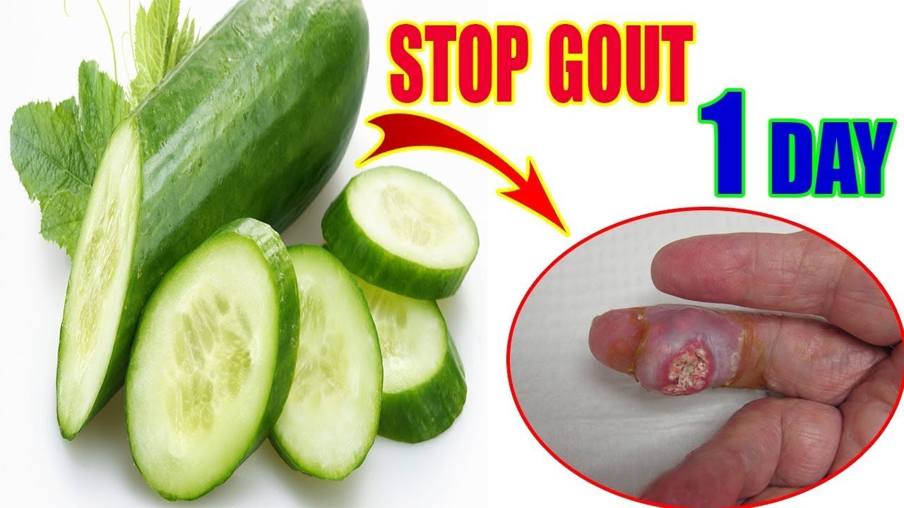 The Best Food For Gout Naturaly  Cucumber Amazing Fruit ...