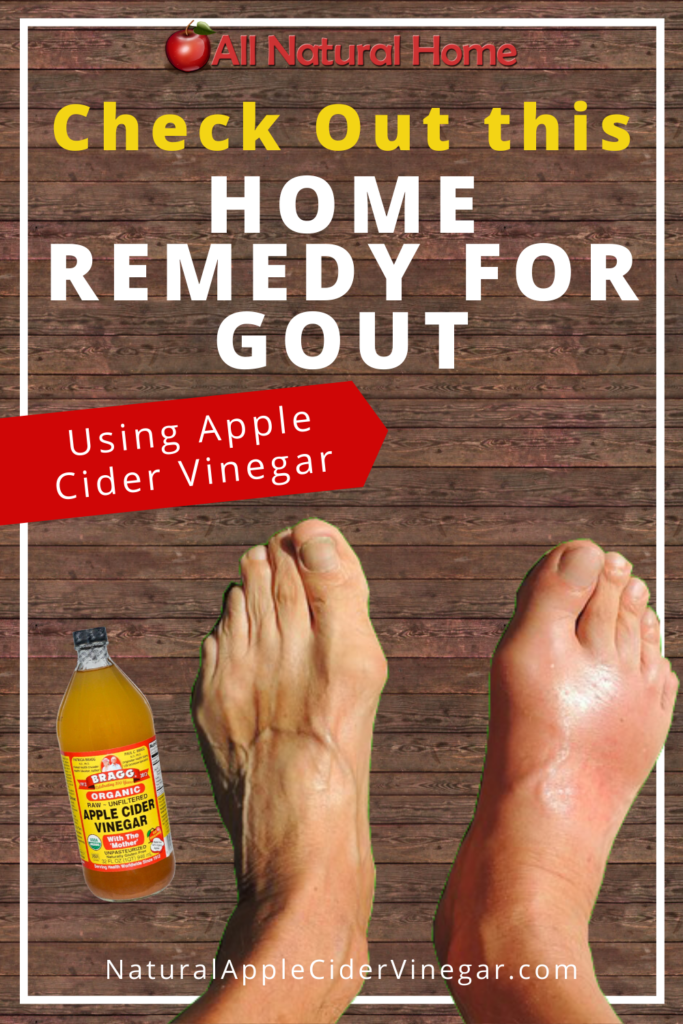 The Best Home Remedy for Gout: Apple Cider Vinegar