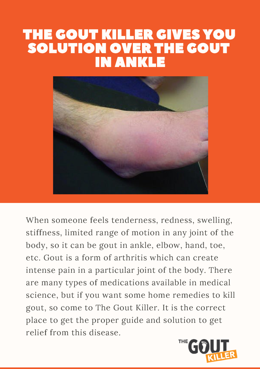 The Gout Killer Gives You Solution Over the Gout in Ankle ...