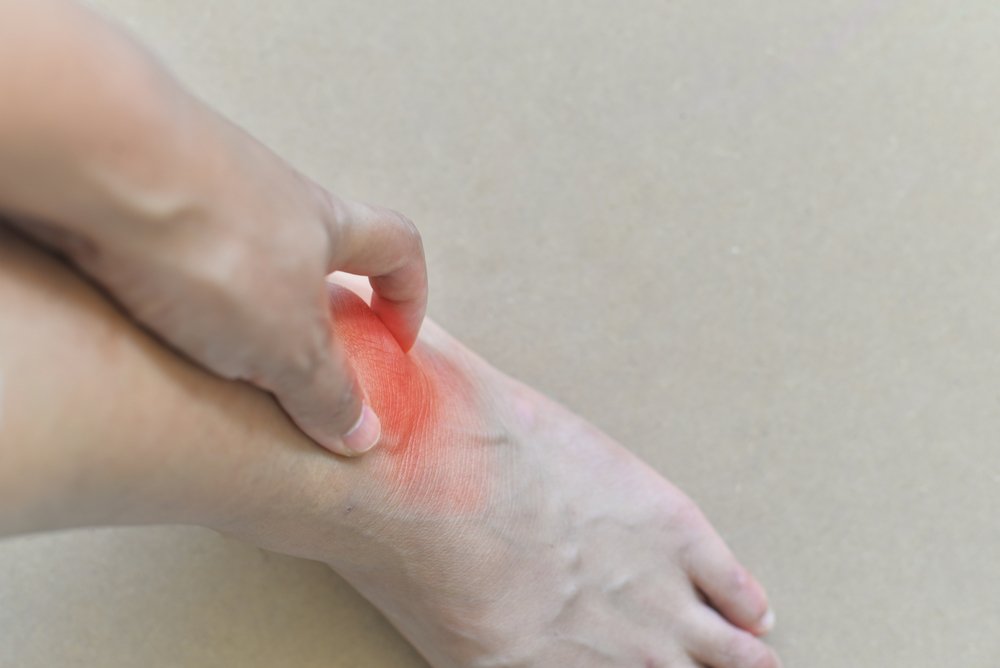 Tips To Control Gout Naturally