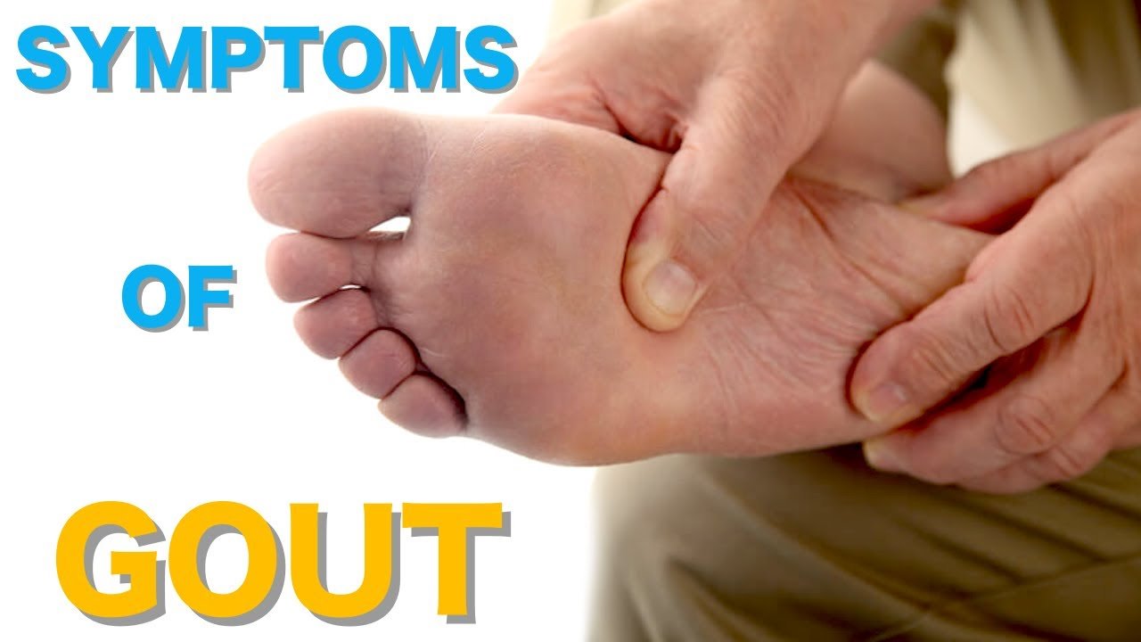 Top 10 Common Gout Symptoms Causes of Gout Symptoms of ...