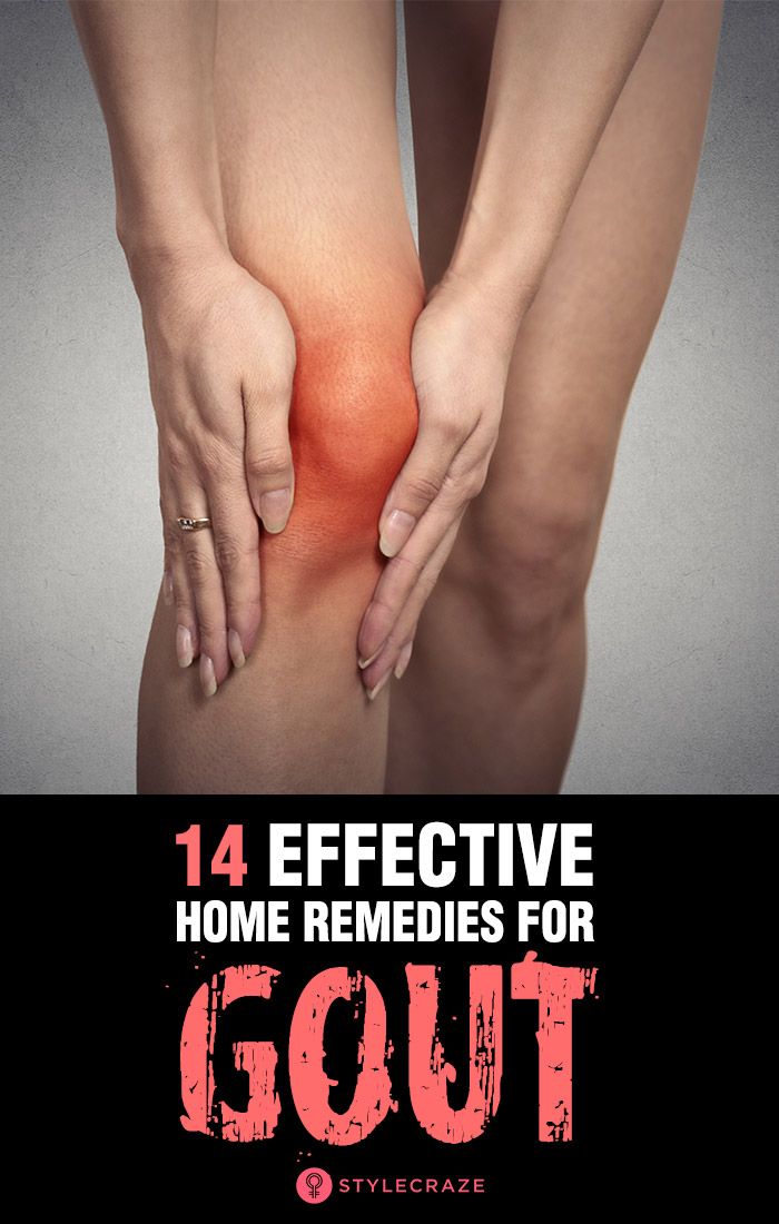 Top 14 Effective Home Remedies For Gout