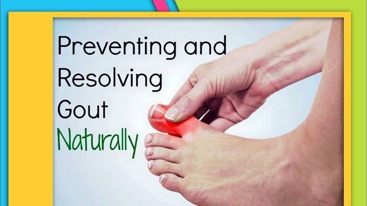 TOP 3 Herbal Supplements to Heal GOUT. Natural GOUT Treatment/RELIEF ...