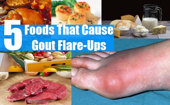 Top 5 Foods That Cause Gout Flare
