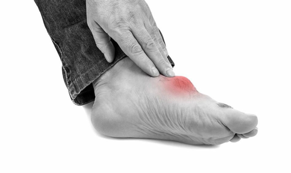Top triggers for gout foot pain Â» SearchInsider