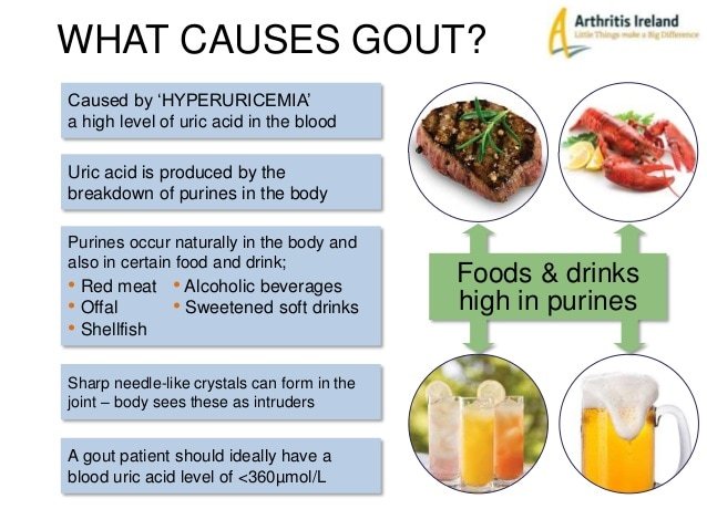 What Causes Gout? 8 Foods That Trigger Attacks * Arthritis ...