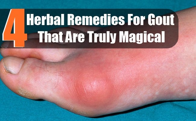 What causes gout in the knee?